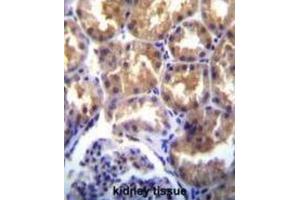 Immunohistochemistry (IHC) image for anti-Transient Receptor Potential Cation Channel, Subfamily M, Member 6 (TRPM6) antibody (ABIN3003652)