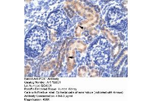 Immunohistochemistry (IHC) image for anti-phosphoenolpyruvate Carboxykinase 1 (Soluble) (PCK1) (Middle Region) antibody (ABIN2777603)