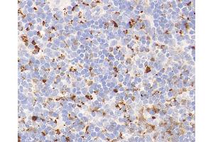 Immunohistochemistry analysis of parafffin-embedded mouse spleen using Lysozyme Polyclonal Antibody at dilution of 1:400. (LYZ antibody)
