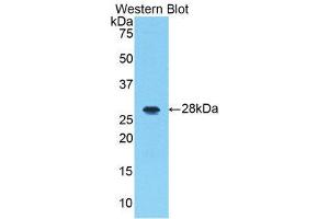 Western Blotting (WB) image for anti-Interleukin-1 Receptor-Associated Kinase 1 (IRAK1) (AA 212-440) antibody (ABIN3206503) (IRAK1 antibody  (AA 212-440))