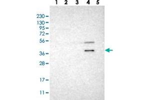 Western blot analysis of Lane 1: RT-4, Lane 2: U-251 MG, Lane 3: Human Plasma, Lane 4: Liver, Lane 5: Tonsil with WNT7A polyclonal antibody . (WNT7A antibody)