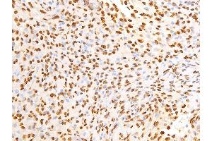 Immunohistochemistry (IHC) image for anti-Epidermal Growth Factor Receptor (EGFR) (pSer695) antibody (ABIN6255471)