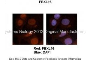Researcher: Dr. (FBXL16 antibody  (N-Term))