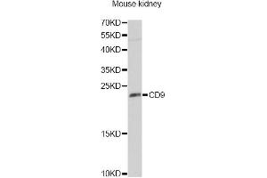 Western blot analysis of extracts of mouse kidney, using CD9 Antibody (ABIN5970852) at 1/1000 dilution. (CD9 antibody)