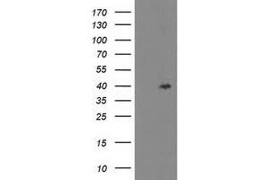Western Blotting (WB) image for anti-TBC1 Domain Family, Member 21 (TBC1D21) antibody (ABIN1501317) (TBC1D21 antibody)