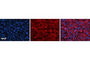 Rabbit Anti-FBXO21 Antibody Catalog Number: ARP43176_P050 Formalin Fixed Paraffin Embedded Tissue: Human Liver Tissue Observed Staining: Cytoplasm in hepatocytes Primary Antibody Concentration: 1:100 Other Working Concentrations: 1:600 Secondary Antibody: Donkey anti-Rabbit-Cy3 Secondary Antibody Concentration: 1:200 Magnification: 20X Exposure Time: 0. (FBXO21 antibody  (C-Term))