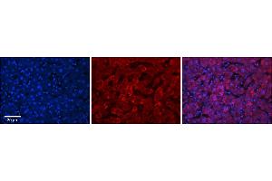 Rabbit Anti-UGT1A7 Antibody      Formalin Fixed Paraffin Embedded Tissue: Human Adult Liver   Observed Staining: Cytoplasm in hepatocytes, strong signal, wide tissue distribution  Primary Antibody Concentration: 1:100  Secondary Antibody: Donkey anti-Rabbit-Cy3  Secondary Antibody Concentration: 1:200  Magnification: 20X  Exposure Time: 0. (UGT1A7 antibody  (N-Term))