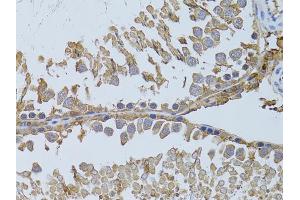 Immunohistochemistry of paraffin-embedded rat testis using HDAC8 antibody (ABIN5973443) at dilution of 1/100 (40x lens). (HDAC8 antibody)