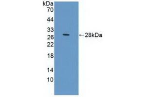 Detection of Recombinant PRLR, Human using Polyclonal Antibody to Prolactin Receptor (PRLR) (Prolactin Receptor antibody  (AA 25-234))