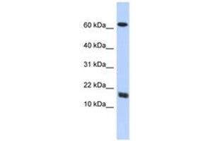 Image no. 1 for anti-Chromosome 4 Open Reading Fram 46 (C4orf46) (AA 35-84) antibody (ABIN6741114) (C4orf46 antibody  (AA 35-84))