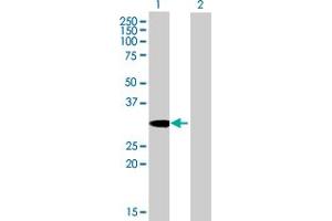 Western Blot analysis of SDCBP expression in transfected 293T cell line by SDCBP MaxPab polyclonal antibody. (SDCBP antibody  (AA 1-298))