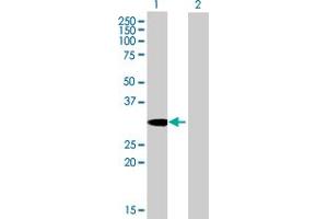 Western Blot analysis of SDCBP expression in transfected 293T cell line by SDCBP MaxPab polyclonal antibody. (SDCBP antibody  (AA 1-298))