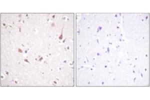 Immunohistochemistry analysis of paraffin-embedded human brain tissue, using Mst1/2 (Ab-183) Antibody.