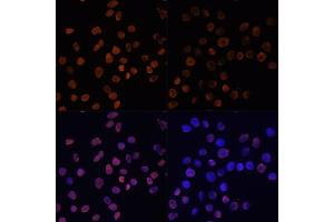 Immunofluorescence analysis of HeLa cells using Acetyl-Histone H2A-K5 antibody (ABIN7267722) at dilution of 1:100. (Histone H2A antibody  (acLys5))
