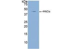 Detection of Recombinant NPPA, Mouse using Polyclonal Antibody to Natriuretic Peptide Precursor A (NPPA) (NPPA antibody  (AA 25-152))