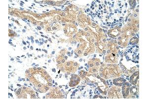 NXF5 antibody was used for immunohistochemistry at a concentration of 4-8 ug/ml to stain Epithelial cells of renal tubule (arrows) in Human Kidney.