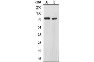 Western blot analysis of EOMES expression in HepG2 (A), IMR32 (B) whole cell lysates. (EOMES antibody  (N-Term))