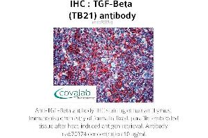 Image no. 1 for anti-TGF-beta (TGFb) antibody (ABIN1723276) (TGF-beta antibody)