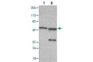 Western blot analysis of Lane 1: Human cell line RT-4 Lane 2: Human cell line U-251MG sp with G6PD polyclonal antibody  at 1:100-1:250 dilution. (Glucose-6-Phosphate Dehydrogenase antibody)