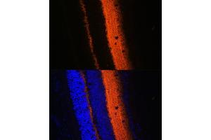 Immunofluorescence analysis of mouse eye using SYT1 Rabbit pAb (ABIN3021249, ABIN3021250, ABIN3021251 and ABIN6214085) at dilution of 1:100 (40x lens). (SYT1 antibody  (AA 1-422))