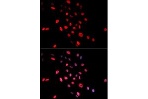 Immunofluorescence (IF) image for anti-Jun Proto-Oncogene (JUN) (pSer63) antibody (ABIN1870292) (C-JUN antibody  (pSer63))