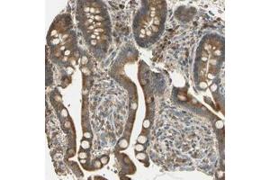 Immunohistochemical staining of human colon with STX18 polyclonal antibody  shows cytoplasmic positivity in glandular cells. (Syntaxin 18 antibody)