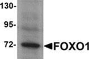 Western blot analysis of FOXO1 in Hela cell lysate with FOXO1 antibody at 1 μg/ml.