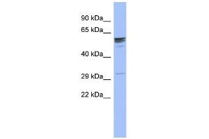 WB Suggested Anti-ZNF146 Antibody Titration:  0. (ZNF146 antibody  (Middle Region))