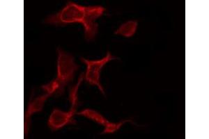 ABIN6267267 staining SK-OV3 by IF/ICC. (EGFR antibody  (pSer695))