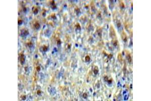 Used in DAB staining on fromalin fixed paraffin-embedded Liver tissue (PSIP1 antibody  (AA 311-469))