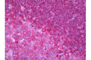 Anti-CD79B antibody IHC of human tonsil. (CD79b antibody  (Intracellular))