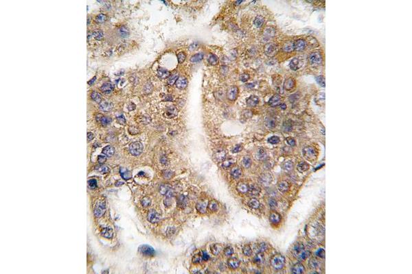 TRAIP antibody  (C-Term)