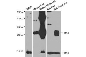 Western blot analysis of extracts of various cell lines, using HBA1 antibody (ABIN4903869) at 1:1000 dilution. (HBA1 antibody)