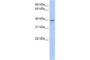 WB Suggested Anti-LIX1L Antibody Titration: 0.