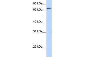 WB Suggested Anti-C14orf37 Antibody Titration:  0. (C14ORF37 antibody  (N-Term))