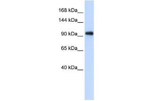 WB Suggested Anti-EXOSC10 Antibody Titration:  0. (EXOSC10 antibody  (C-Term))
