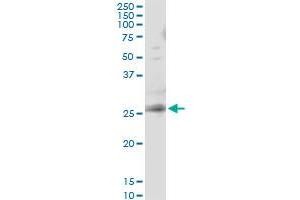 Immunoprecipitation of RAB3B transfected lysate using anti-RAB3B monoclonal antibody and Protein A Magnetic Bead , and immunoblotted with RAB3B MaxPab rabbit polyclonal antibody. (RAB3B antibody  (AA 120-219))