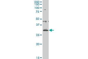 CITED1 monoclonal antibody (M03), clone 5H6 Western Blot analysis of CITED1 expression in A-431 . (CITED1 antibody  (AA 94-193))
