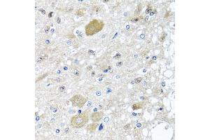 Immunohistochemistry of paraffin-embedded rat brain using CST1 antibody (ABIN5975714) at dilution of 1/100 (40x lens). (CST1 antibody)