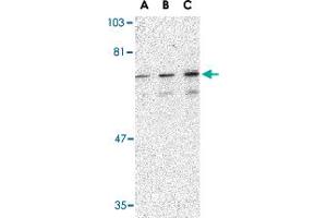 Western blot analysis of PTPN11 in mouse skeletal muscle tissue lysate with PTPN11 polyclonal antibody  at (A) 0. (PTPN11 antibody  (C-Term))