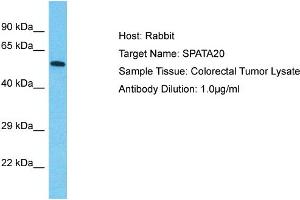 Host: Rabbit Target Name: SPATA20 Sample Type: Colorectal Tumor lysates Antibody Dilution: 1. (SPATA20 antibody  (C-Term))
