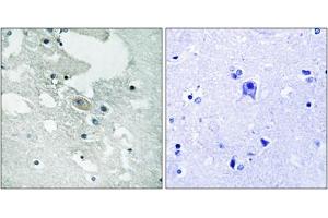 Immunohistochemical staining of paraffin-embedded human brain tissue reacted with BLNK (phospho Y84) polyclonal antibody  at 1:50-1:100 dilution. (B-Cell Linker antibody  (pTyr84))