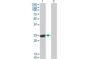 Western Blot analysis of COMT expression in transfected 293T cell line by COMT monoclonal antibody (M01), clone 1G4-1A1. (COMT antibody  (AA 1-182))