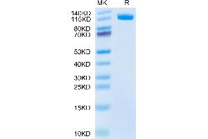 ENPP3 Protein (AA 46-874) (His tag)