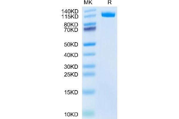 ENPP3 Protein (AA 46-874) (His tag)