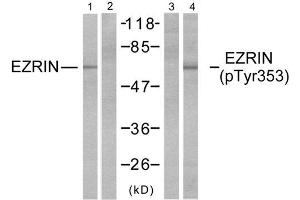 Western blot analysis of extracts from A431 cells, untreated or EGF-treated (200ng/ml, 30min) using Ezrin (Ab-353) antibody (E021094, Lane 1 and 2) and Ezrin (phospho-Tyr353) antibody (E011063, Lane 3 and 4). (Ezrin antibody)