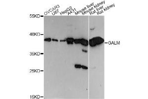 Western blot analysis of extracts of various cell lines, using GALM antibody (ABIN6292969) at 1:3000 dilution. (GALM antibody)