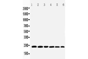 Anti-SNAP23 antibody, Western blotting Lane 1: Rat Spleen Tissue Lysate Lane 2: Rat testis Tissue Lysate Lane 3: Rat Ovary Tissue Lysate Lane 4: HELA Cell Lysate Lane 5: MCF-7 Cell Lysate Lane 6: SKOV Cell Lysate (SNAP23 antibody  (C-Term))
