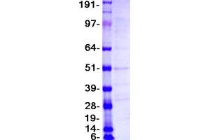 Validation with Western Blot (CD52 Protein (CD52) (Myc-DYKDDDDK Tag))