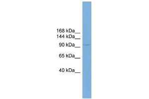 WB Suggested Anti-PIWIL4 Antibody Titration: 0. (PIWIL4 antibody  (N-Term))